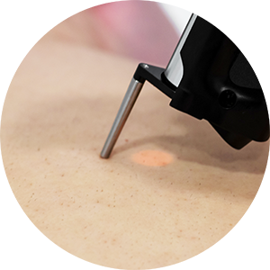 icon-laser-treatments